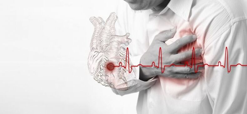 širdies priepuolis kaip skausmo po kairiuoju pečių ašmenimis priežastis