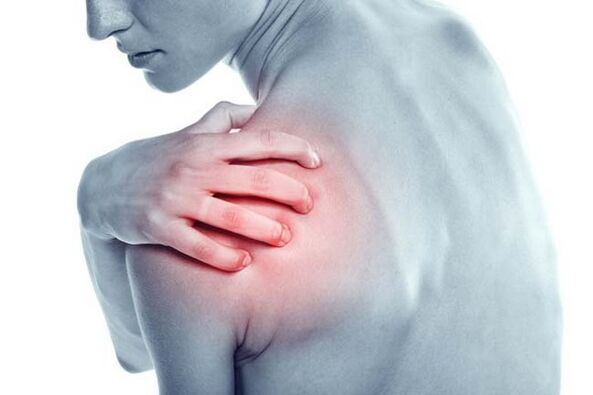 Skausmingas peties skausmas yra peties sąnario artrozės simptomas
