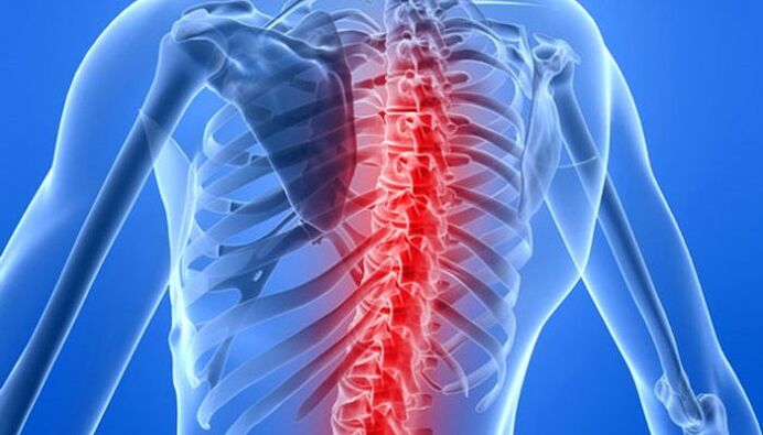 Stuburo patologijos yra dažniausios nugaros skausmo priežastys pečių srityje