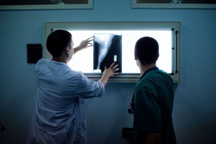 Arthrozės diagnozė x -sraute