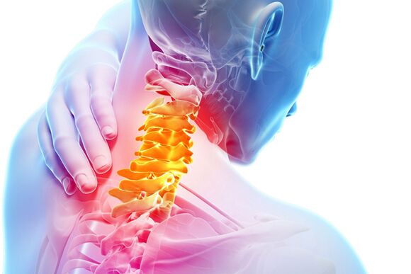 Gimdos kaklelio osteochondrozė