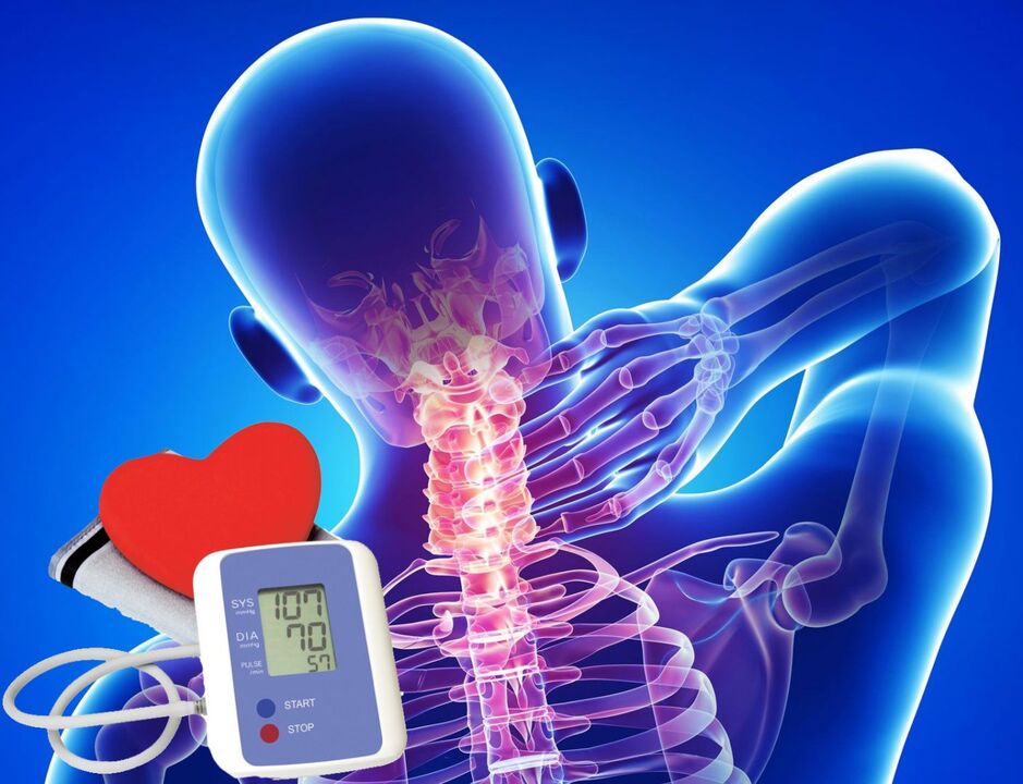 Kraujospūdžio padidėjimas sergant gimdos kaklelio osteochondroze
