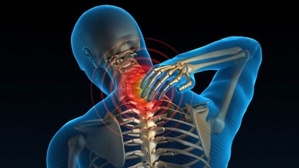 Skausmas sukant kaklą gali rodyti stuburo kaklo osteochondrozės sindromą